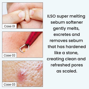 ILSO Super Melting Sebum Softener 150ml