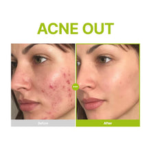 Load image into Gallery viewer, Purito Seoul Azelaic Acid 10 Kojic Azulene Serum 30ml