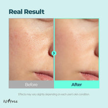 Load image into Gallery viewer, Isntree Gim PDRN Hydro Bouncy Ampoule 50ml