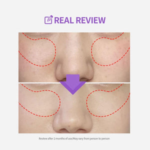SUNGBOON EDITOR Meoru Podo VitaC Dark Spot Pad 60EA