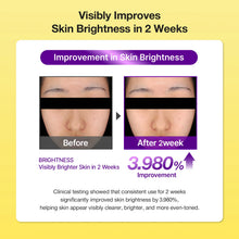 Load image into Gallery viewer, Nineless B-Boost 1% Kojic Acid Toner 200ml