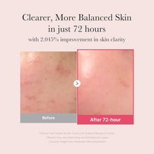 Load image into Gallery viewer, Medicube TXA Niacinamide 15% Serum 30ml