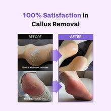 Load image into Gallery viewer, baren Callus Remover Kit for Feet: Foot File &amp; Peeling Foot Spray