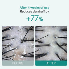 Load image into Gallery viewer, Lilyeve Scalp:Turn Cica PDRN Brush Ampoule 100ml