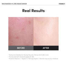Load image into Gallery viewer, FRANKLY Niacinamide 15% Zinc Beads Serum 30ml
