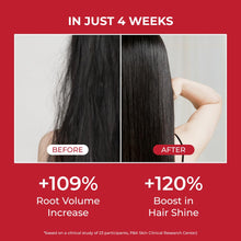 Load image into Gallery viewer, MOEV Annurcatin™ Shampoo 300ml