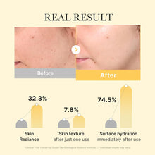 Load image into Gallery viewer, Medicube Kojic Acid Turmeric Gel Mask 2EA