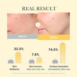 Medicube Kojic Acid Turmeric Gel Mask 2EA