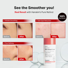 Load image into Gallery viewer, Hanskin Vitamin A Glow Retinol Serum 30ml