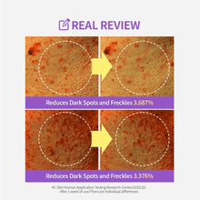 Load image into Gallery viewer, SUNGBOON EDITOR Meoru Podo VitaC Dark Spot Pad 60EA