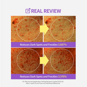 SUNGBOON EDITOR Meoru Podo VitaC Dark Spot Pad 60EA