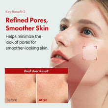 Load image into Gallery viewer, Hanskin Vitamin A Glow Retinol Serum 30ml