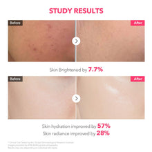 Load image into Gallery viewer, AprilSkin TXA Niacinamide Collagen 99 Capsule Gel Mask 4EA