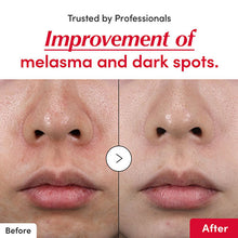 Load image into Gallery viewer, EQQUALBERRY Vitamin Illuminating Serum 30ml