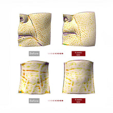 Load image into Gallery viewer, Centellian24 Madeca Cream Time Reverse 50ml