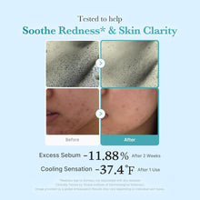 Load image into Gallery viewer, MEDICUBE Azelaic Acid Niacinamide Clear Toner 250ml