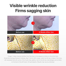 Load image into Gallery viewer, Centellian24 Madeca Cream Time Reverse 50ml