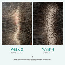 Load image into Gallery viewer, Lilyeve Scalp:Turn Cica PDRN Brush Ampoule 100ml