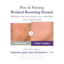 Load image into Gallery viewer, Medicube Retinol NMN Boosting Serum 30ml