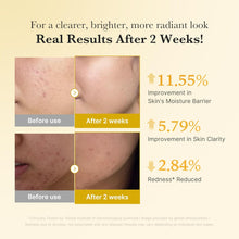 Load image into Gallery viewer, Medicube Kojic Acid Turmeric Niacinamide Serum 30ml