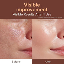 Load image into Gallery viewer, ID Placosmetics Exo-V Booster Ampoule 30ml