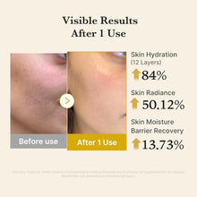 Load image into Gallery viewer, MEDICUBE Kojic Acid Termeric Vita Jelly Mist Serum 100ml