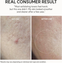 Load image into Gallery viewer, Arencia Eraser Shot Glycolic Acid Exfoliator 200ml