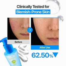 Load image into Gallery viewer, Numbuzin Zero Blemish Oil-Free Micellar Cleansing Jelly 200ml