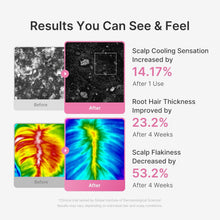 Load image into Gallery viewer, MEDICUBE Roseymary PDRN Scalp Serum 20ml