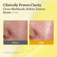 Load image into Gallery viewer, FULLY Lemon Vita Bubble Mask Cleanser 150ml