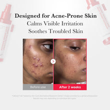 Load image into Gallery viewer, MEDICUBE Hypochlorous Acid Daily Facial Spray 125ml