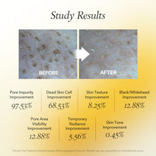 Load image into Gallery viewer, April Skin Calendula Peel Off Mask 100g
