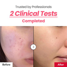 Load image into Gallery viewer, Dr.Percent Dark Spot 24% Correcting Pink Glow Cream 30ml