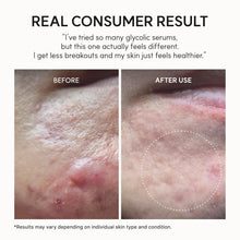 Load image into Gallery viewer, ARENCIA Eraser Shot Glycolic Acid Booster 30ml