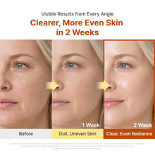 Load image into Gallery viewer, Sungboon Editor Kojic Acid Niacinamide Brightening Capsule Cream 50ml