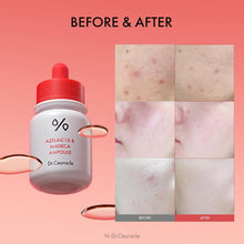 Load image into Gallery viewer, Dr.Ceuracle Azelaic10 &amp; Madeca Ampoule 30ml
