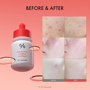 Dr.Ceuracle Azelaic10 & Madeca Ampoule 30ml