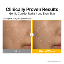 Load image into Gallery viewer, Numbuzin No.5 Vitamin Concentrated Serum 30ml