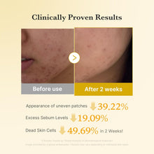 Load image into Gallery viewer, Medicube Kojic Acid Turmeric Pad 70EA