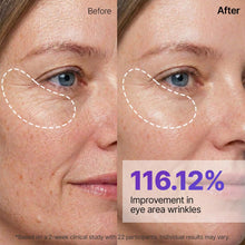 Load image into Gallery viewer, Sungboon Editor Silk Peptide EGF Gold Mask 4EA