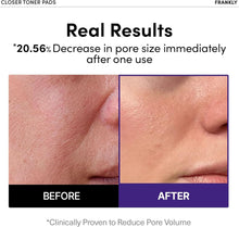 Load image into Gallery viewer, FRANKLY Closer Toner Pads 105ml