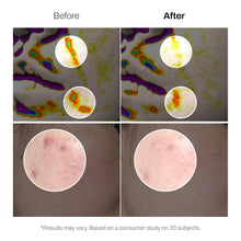 Load image into Gallery viewer, MEDITHERAPY Retinal Skin Booster Serum 150ml