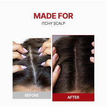 Load image into Gallery viewer, KUNDALHead Spa &amp; Scalp Care Scalp Tonic 100ml