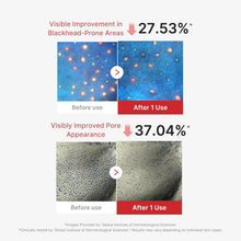 Load image into Gallery viewer, MEDICUBE Hypochlorous Acid Peel Mask 3EA