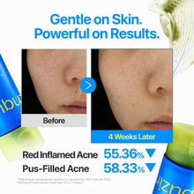 Load image into Gallery viewer, Numbuzin Zero Blemish Clarifying 2% Sulfur Cleansing Foam 150ml