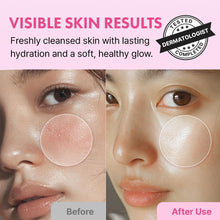 Load image into Gallery viewer, Hanskin Real Complexion Hyaluron Bubble Pop Cleanser 150ml
