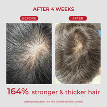 Load image into Gallery viewer, MOEV Annurcatin™ Shampoo 300ml