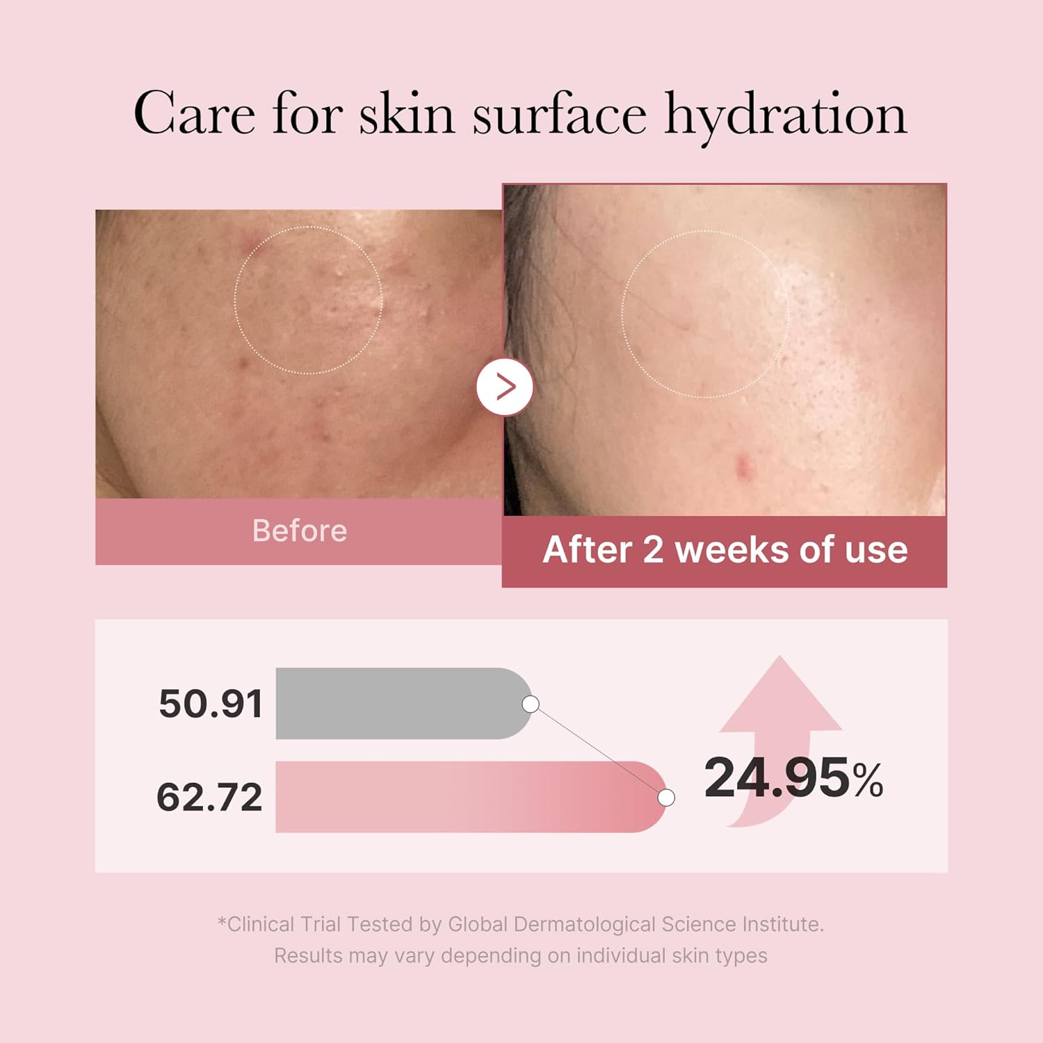 Medicube PDRN Pink Glutathione Serum Mist 100ml SoKoSkins Medicube PDRN Pink Glutathione Serum Mist 100ml SoKoSkins