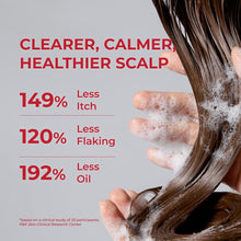 Load image into Gallery viewer, MOEV Annurcatin™ Shampoo 300ml
