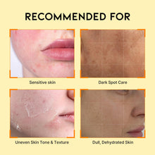 Load image into Gallery viewer, OOTD Dark Spot Vitamin C Serum 50ml